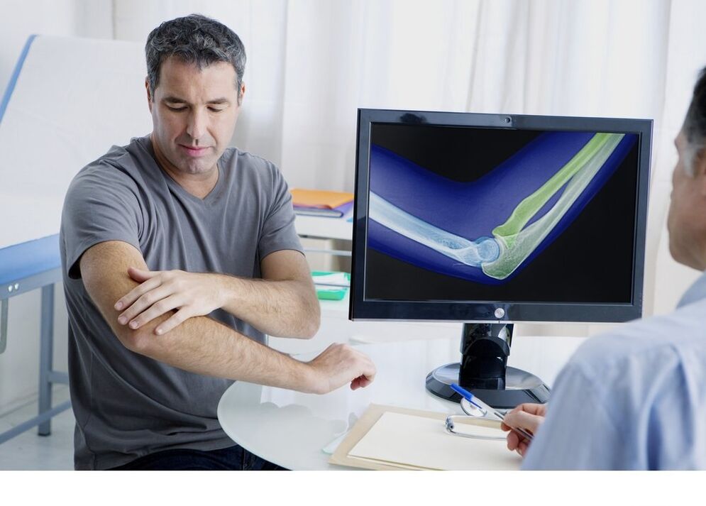 Arthrosis of the shared elbow in the X -RAY image