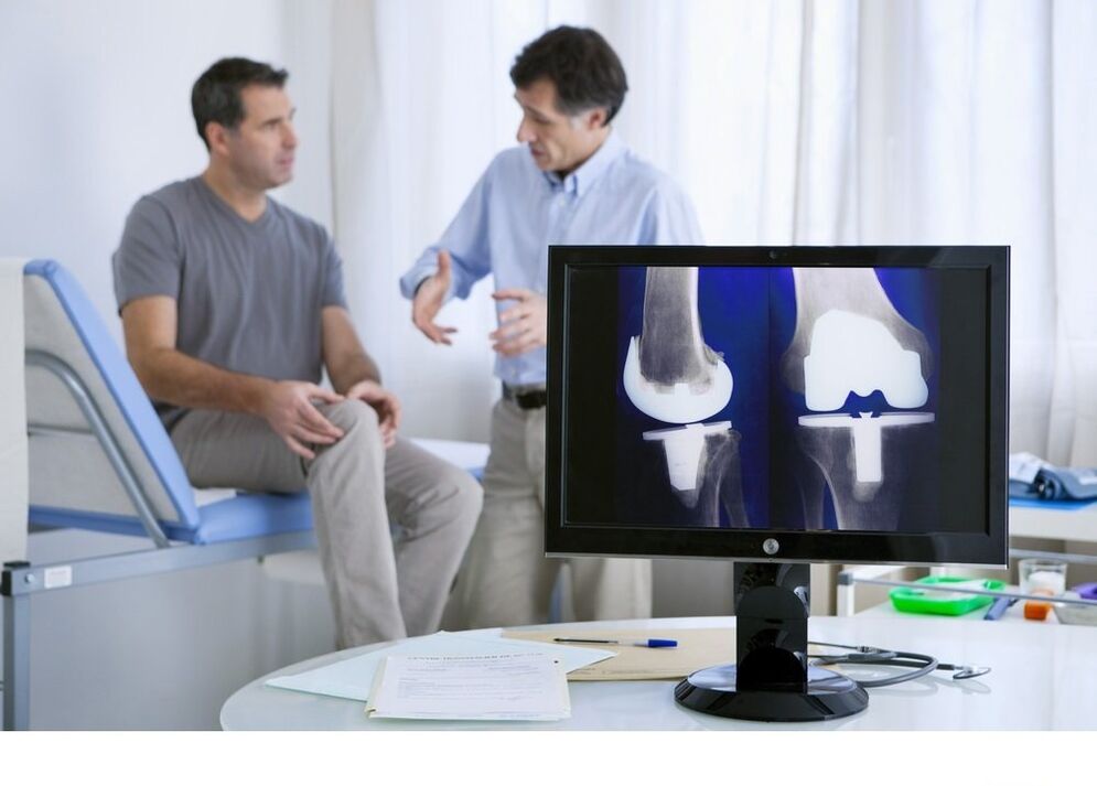 Knee wrist Arthrosis in X -Ray image